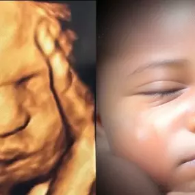 Bild von Chubby Cheeks 3D/4D Ultrasound Studio of Burlington