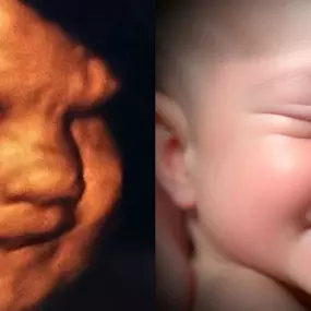 Bild von Chubby Cheeks 3D/4D Ultrasound Studio of Burlington