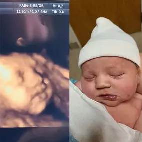 Bild von Chubby Cheeks 3D/4D Ultrasound Studio of Burlington