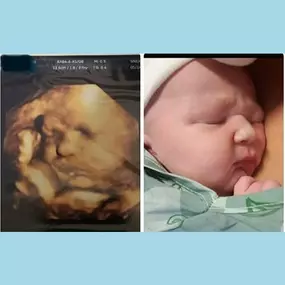 Bild von Chubby Cheeks 3D/4D Ultrasound Studio of Burlington