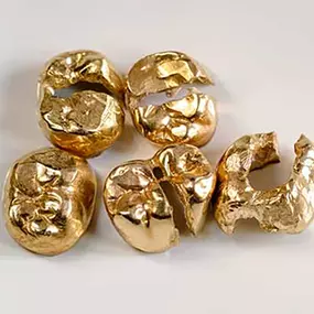 Bild von Struck-Gold | Gold und Silber Ankauf in Celle | Ankauf von Edelmetallen