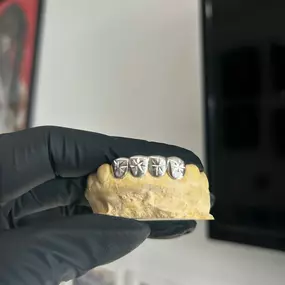 Bild von Torres Realm Custom Grillz & Jewelry