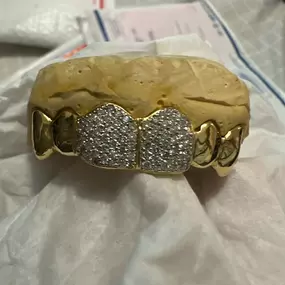 Bild von Torres Realm Custom Grillz & Jewelry