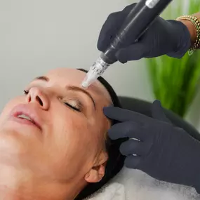 Kristin Ellyn Aesthetics - Botox Cosmetic Injections