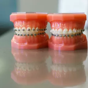 We value excellence at Signature Orthodontics. We make sure to use only the best in technology, techniques, and materials. Our certified, trained dental assistants take meticulous care in sterilizing our instruments with efficiency and the best in steam and heat technology. We have an on-site Planmeca digital Panoramic and Cephalometric x-ray machine and an iTero, the intra-oral digital scanner. This means everything you could possibly need to get your treatment started, is available in our offi
