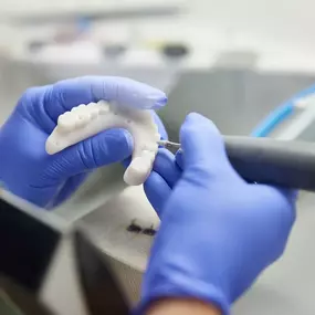 Bild von ArchONE Full Arch Implants