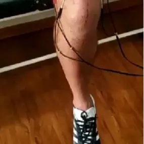 fotorodillalesionfisioterapia.png