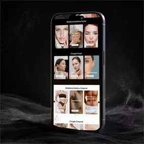 Bluestage Marketing showcases a fully customized multilingual website launched for a Botox clinic in Spain, Europe.