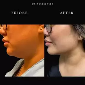 Bild von Finesse Cosmetic Surgery