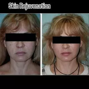 Bild von Finesse Cosmetic Surgery