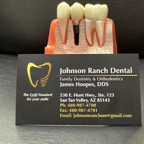 Crowns And Bridges Specialist
