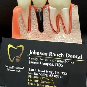 Crowns And Bridges Specialist