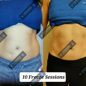 Bild von Cryogenix Wellness Spa
