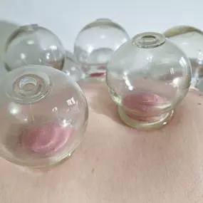 Bild von Akupunktur, traditionelle chinesische Medizin und Naturheilverfahren - TCM Praxis Dr. Miersch