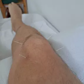 Bild von Akupunktur, traditionelle chinesische Medizin und Naturheilverfahren - TCM Praxis Dr. Miersch