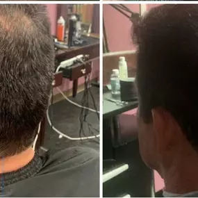 Fancy Hair Gerardo's - Estimulo del crecimiento de cabello
