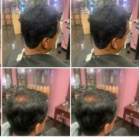 Fancy Hair Gerardo's - Prevencion y detencion de la calvicie
