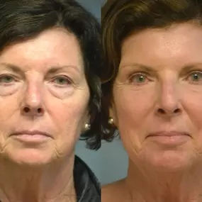 Bild von Providence Facial Plastic and Cosmetic Surgery