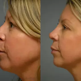 Bild von Providence Facial Plastic and Cosmetic Surgery