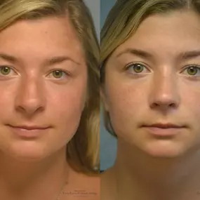Bild von Providence Facial Plastic and Cosmetic Surgery