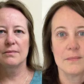 Bild von Providence Facial Plastic and Cosmetic Surgery
