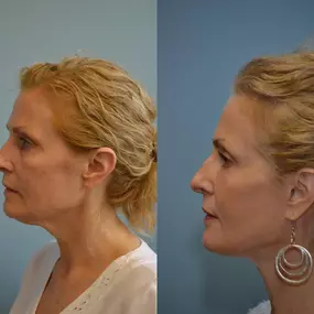 Bild von Providence Facial Plastic and Cosmetic Surgery