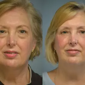 Bild von Providence Facial Plastic and Cosmetic Surgery