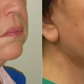 Bild von Providence Facial Plastic and Cosmetic Surgery