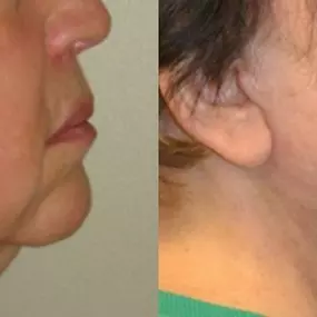 Bild von Providence Facial Plastic and Cosmetic Surgery