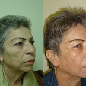 Bild von Providence Facial Plastic and Cosmetic Surgery