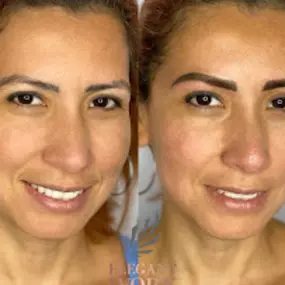 Bild von Elegant Ivory Beauty / Teeth Whitening