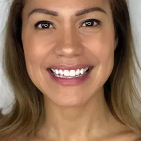 Bild von Elegant Ivory Beauty / Teeth Whitening