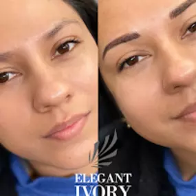 Bild von Elegant Ivory Beauty / Teeth Whitening