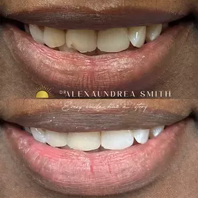 Bild von Overhill Dental