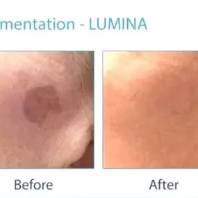 Bild von Beauty in Mind