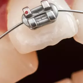 Bild von Diamond Braces Orthodontist: Braces & Invisalign