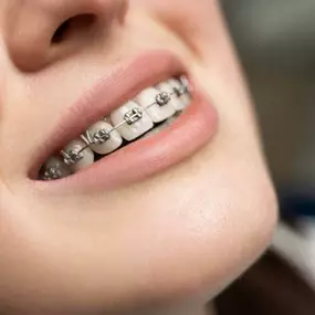 Bild von Diamond Braces Orthodontist: Braces & Invisalign