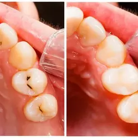 Bild von Irvine Smile Dentistry