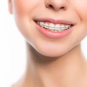 Bild von Irvine Smile Dentistry
