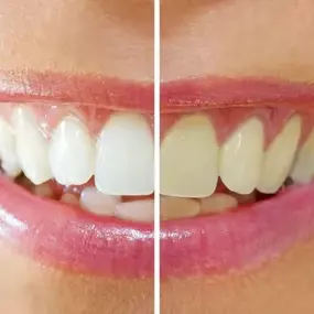 Bild von Irvine Smile Dentistry