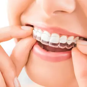 Bild von Diamond Braces Orthodontist: Braces & Invisalign