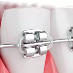Bild von Diamond Braces Orthodontist: Braces & Invisalign