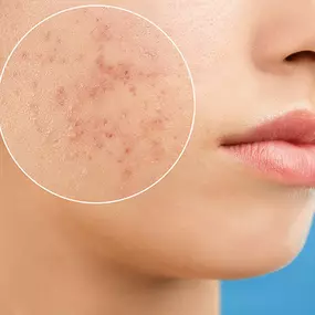 Bild von Pure Face Beauty