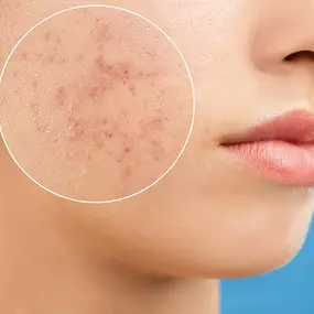 Bild von Pure Face Beauty