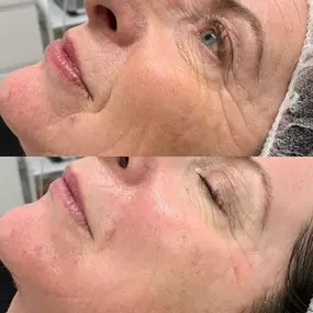Bild von Pure Face Beauty