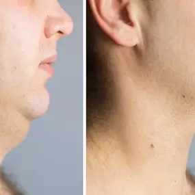 Bild von Bodystyl - anders - schlank