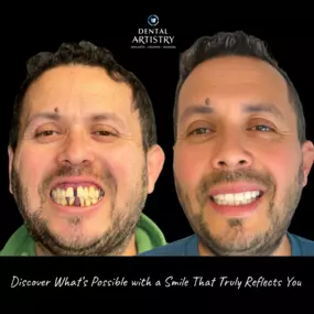 Bild von Dental Artistry Implants - Crowns - Veneers ( Westside )