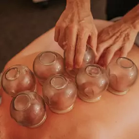 Cupping during massage therapy.