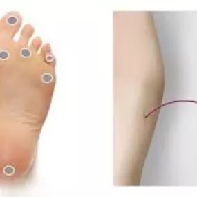 We voeren ook preventieve controles uit bij mensen met een chronische aandoening. We brengen de complicaties in kaart en kunnen een persoonlijk behandelplan voor u opstellen. Eventueel gecombineerd met pedicurezorg