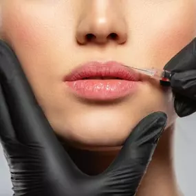 Lip Injectable Fillers